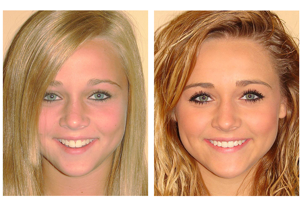 Lashen Klein Dental Group